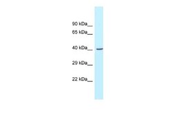 GCAT Rabbit anti-Mouse, Polyclonal, Novus Biologicals 0.1ml; Unconjugated:Antibodies,